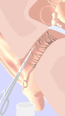 挖耳朵模拟器游戏截图1